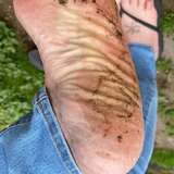 nursefeet71